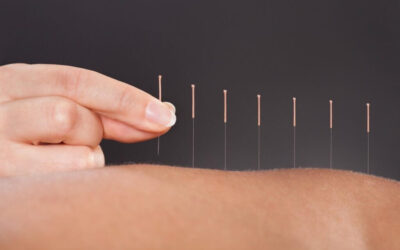 En quoi l’acupuncture est-elle efficace pour la perte de poids ?